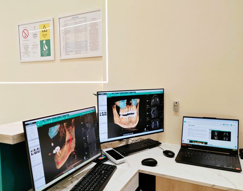 cbct snimanje zuba -Obrada cbct snimka